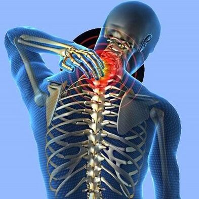 Πόνος στο λαιμό με αυχενική οστεοχονδρία
