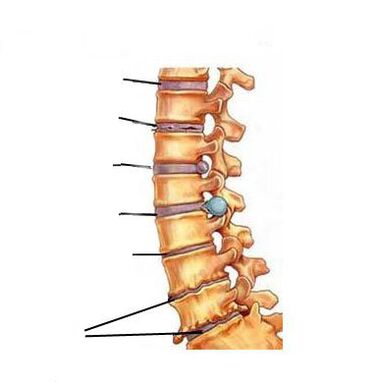 Πώς αναπτύσσεται η οστεοχονδρίαση