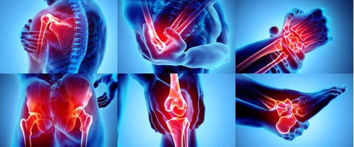 Φλεγμονώδεις αρθρώσεις